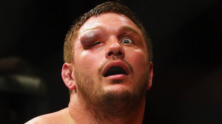 17 януари. Бостън. Мат Митрион е пострадал по време на UFC Fight Night 81.