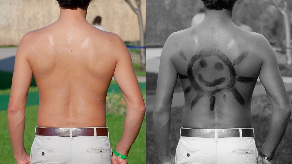 1280px-Sunscreen_on_back_under_normal_and_UV_light