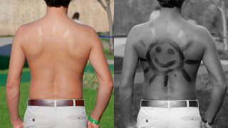 1280px-Sunscreen_on_back_under_normal_and_UV_light