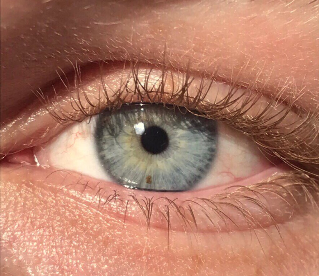 A_close_up_of_a_blue-green_human_iris_(with_visible_freckle).