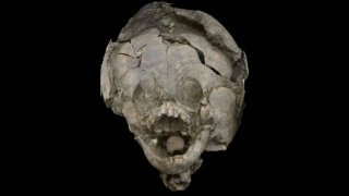 skull-and-helmet-remains
