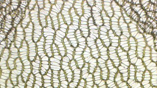 Sphagnum_cells