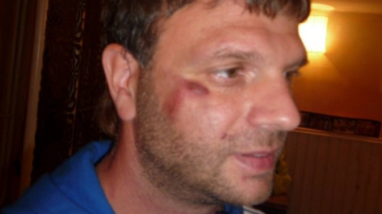 Петър Богданов алармира за полицейско насилие във Facebook и показа снимки