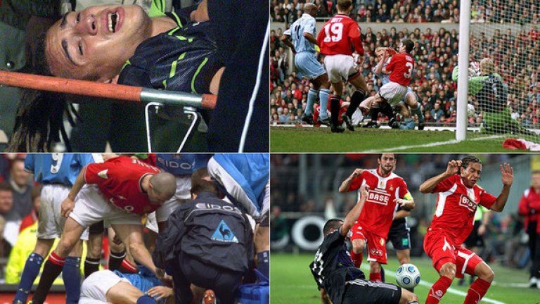 Някои контузии могат да сложат край на кариерата. Дори и да не го направят, футболистите рядко се възстановяват напълно от подобни тежки травми. Предупреждаваме, че някои от снимките са тежки за гледане.