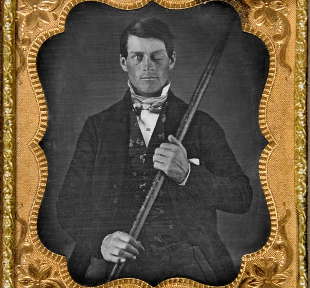 Phineas_Gage_Cased_Daguerreotype_WilgusPhoto2008-12-19_EnhancedRetouched_Color
