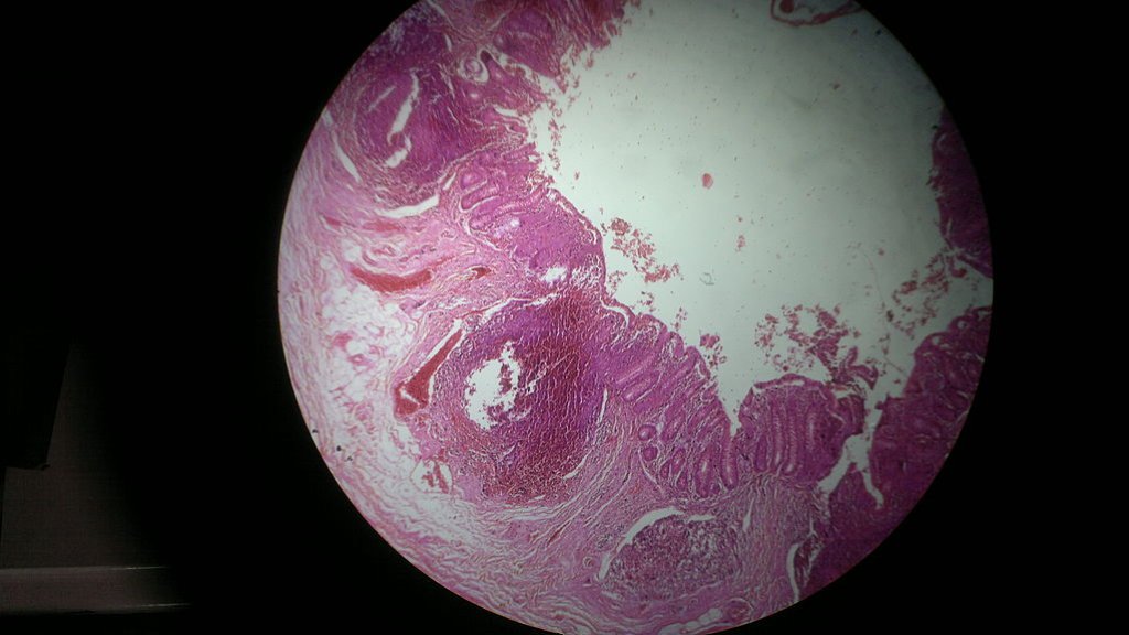 Histology_of_human_appendix