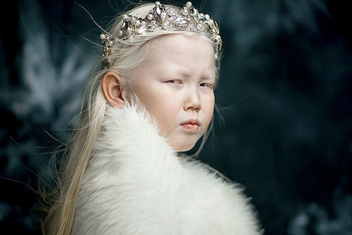 Момичето албинос от Сибир Нараяна стана интернет сензация с прекрасната си фотосесия