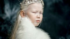 Момичето албинос от Сибир Нараяна стана интернет сензация с прекрасната си фотосесия