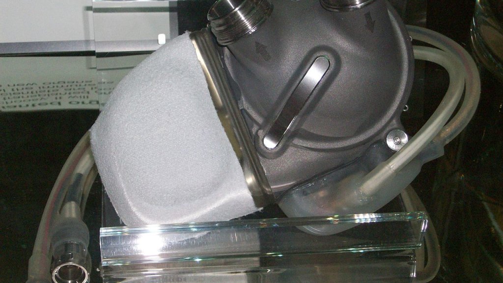1280px-Artificial-heart-london