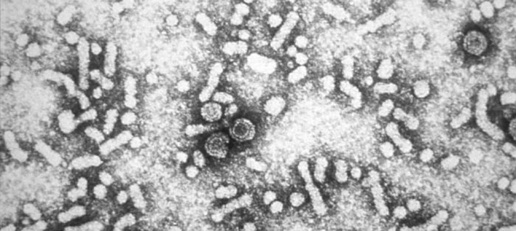 Hepatitis-B_virions