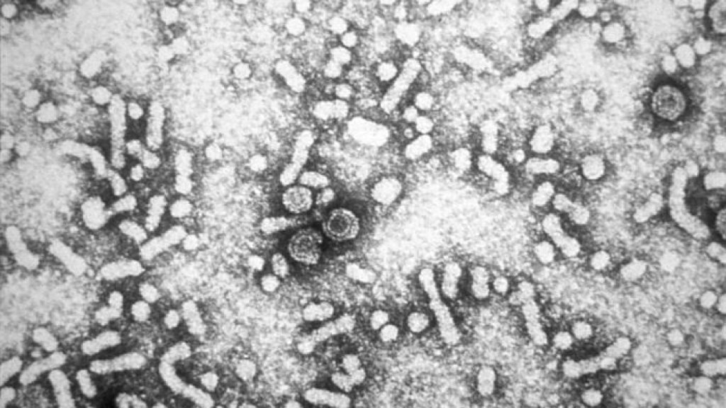 Hepatitis-B_virions