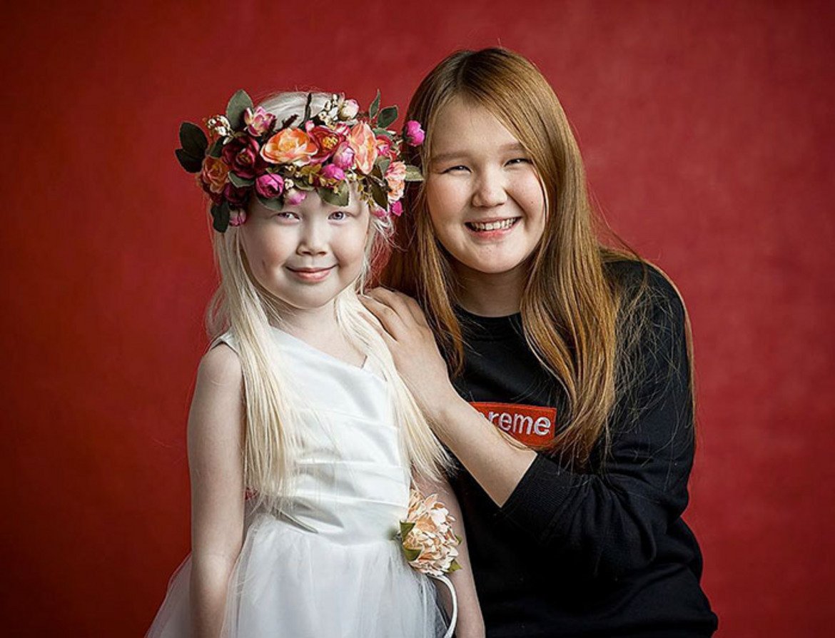 Нараяна е второто дете в семейството и единствения в рода известен албинос, въпреки че албинизмът е смятан за наследствена болест.