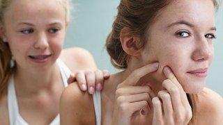 акне, пъпки