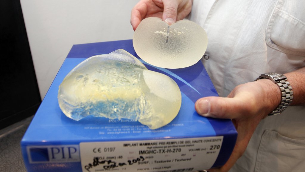 Plastic surgeon Denis Boucq poses holding defective silicone gel breast implants at his office in a clinic in Nice