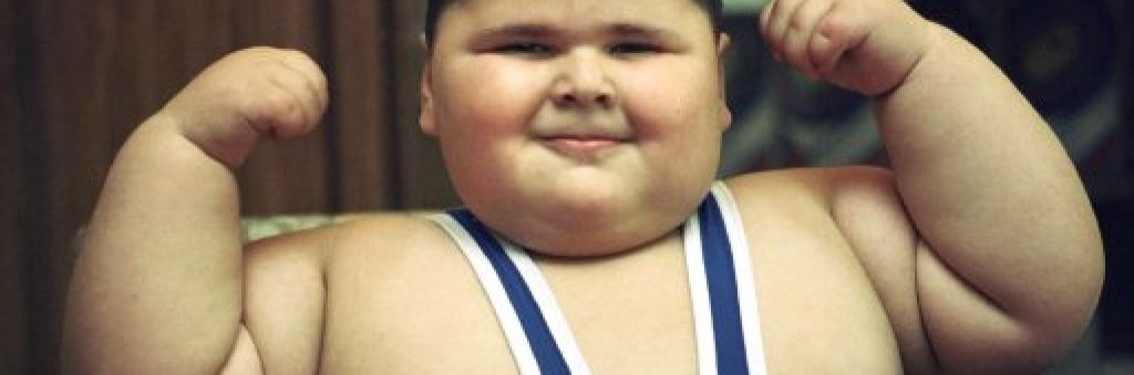 poor-obese-kid