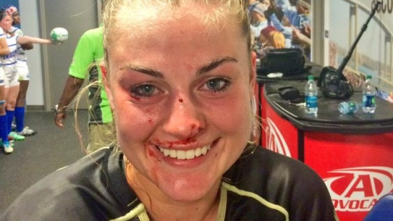 Джорджия Пейдж е щастлива, че случаят ще направи женското ръгби по-популярно