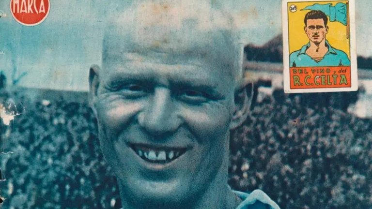 Историята на футболиста, който остана без коса, вежди и мустак