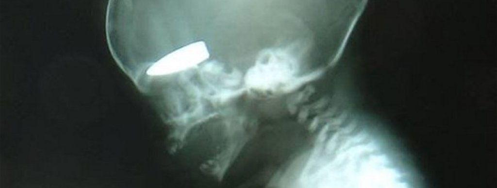 syria-x-ray_2707212b