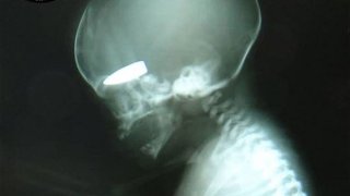syria-x-ray_2707212b