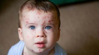 Антиваксърите са все повече, но извиненията им не струват