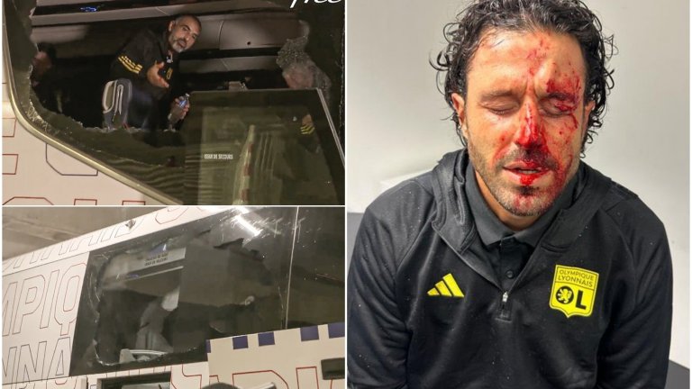 Феновете на Марсилия окървавиха дербито с павета по автобуса на Лион (видео)