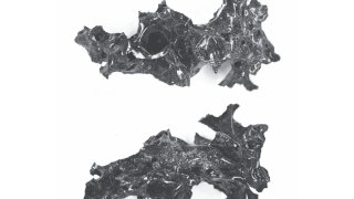 vitrified-brain