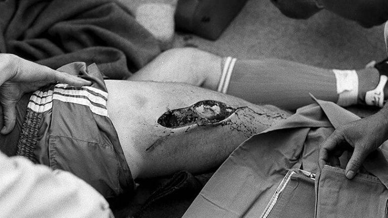 Отворената рана е 25 сантиметра по дължина и дълбока пет сантиметра