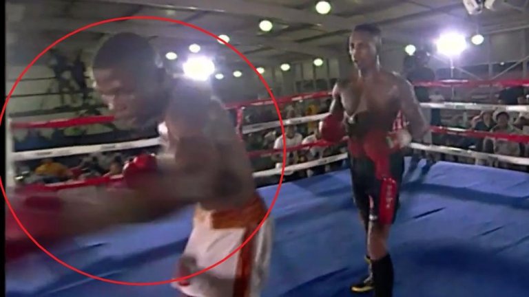 Боксьорът, който се биеше с въображаем противник, изпадна в кома (видео)