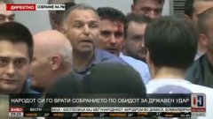 Кадри от окървавеното лице на лидера на СДСМ Зоран Заев
