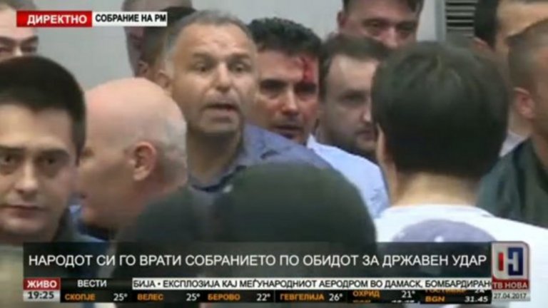 Кадри от окървавеното лице на лидера на СДСМ Зоран Заев