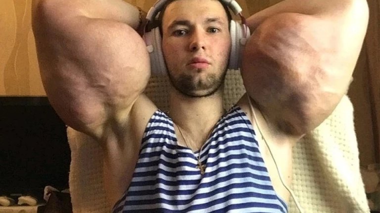 Руки-Базуки с бицепси по-големи от главата: Синтол, вазелин и среща със смъртта