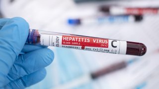 Общо регистрираните заразени в континенталната част на Европа са 102