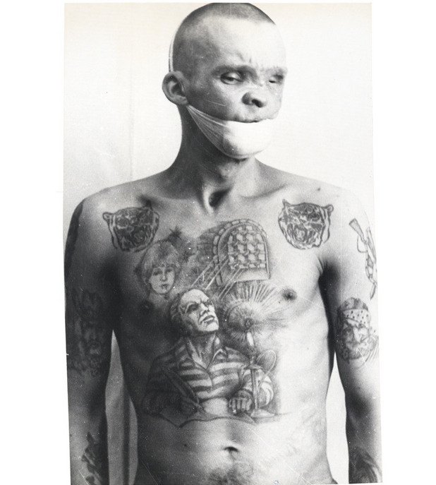 Един от многото затворници, заразени със сифилис, СПИН или 
друга болест, вследствие на татуировки, правени в лоши санитарни условия