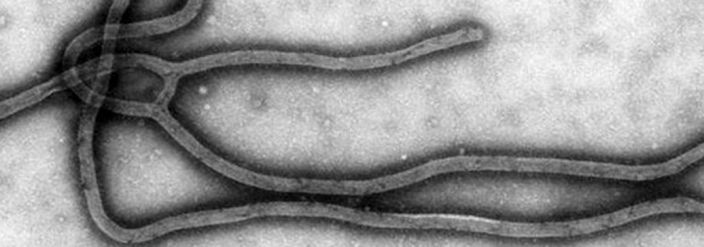 virus