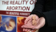 Абортите и историческият избор пред Ирландия