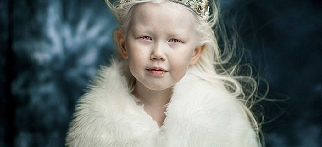 albino-girl-snow-white-nariyana-siberia-15