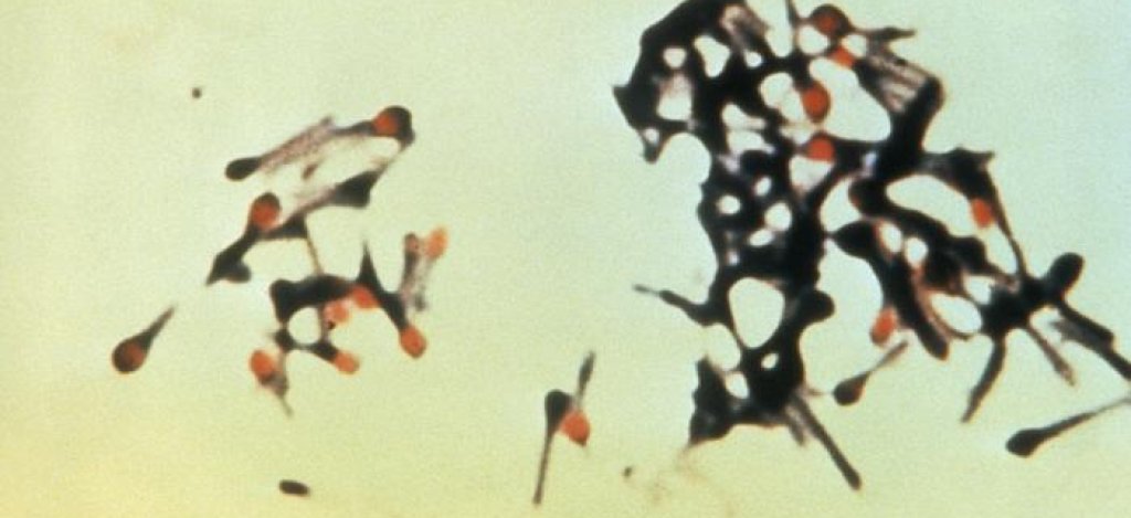 Clostridium_tetani