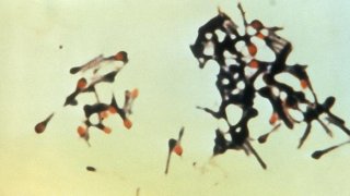 Clostridium_tetani