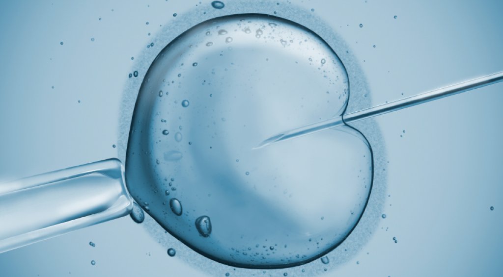 IVF Treatment
