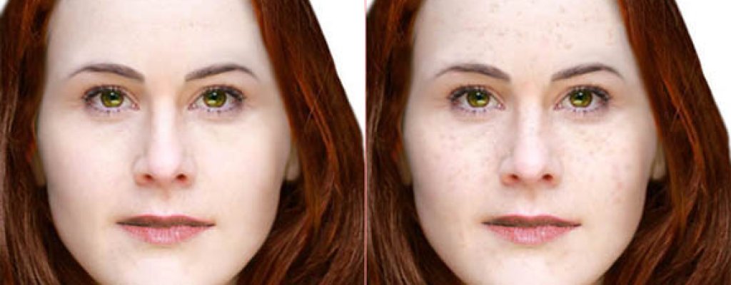 Lady_of_the_Dunes_facial_reconstructions_(with_and_without_freckles)