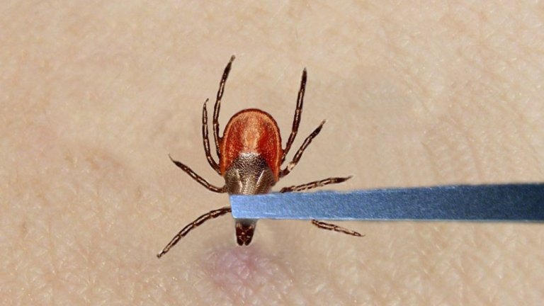Tick-Removal-3