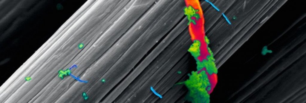 10. Мизофобия
Всички имаме поне един познат, който е маниак на тема чистота и може да мие ръцете си по няколко десетки пъти на ден. Това се дължи на мизофобията – страхът от микроби. Той кара страдащите от него да прекаляват с чистенето и да избягват места и ситуации, които им се струват "мръсни" по техните собствени критерии. Това може да доведе дори до нежеланието за физически контакт с други хора от страх от заразяване с микроби.