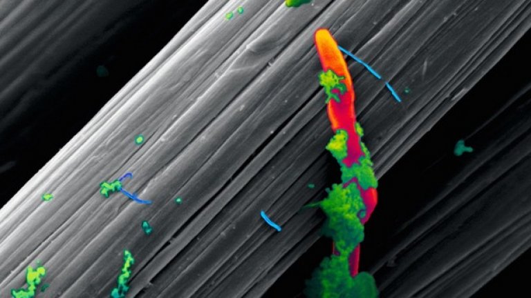 10. Мизофобия
Всички имаме поне един познат, който е маниак на тема чистота и може да мие ръцете си по няколко десетки пъти на ден. Това се дължи на мизофобията – страхът от микроби. Той кара страдащите от него да прекаляват с чистенето и да избягват места и ситуации, които им се струват "мръсни" по техните собствени критерии. Това може да доведе дори до нежеланието за физически контакт с други хора от страх от заразяване с микроби.