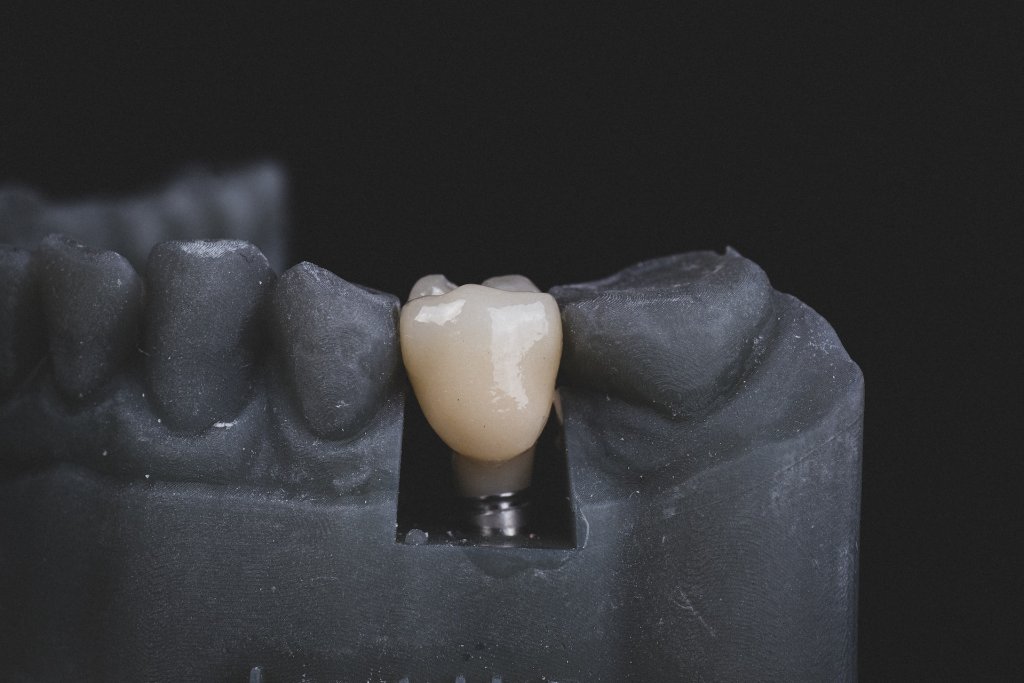 bogdan-condr-q1KLbswF70Y-unsplash