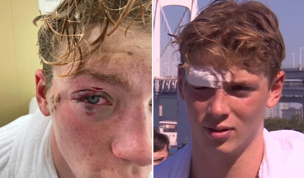 "Окото ми, окото ми изтече във водата!": Олимпиец разказа за преживения ужас