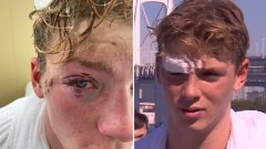 "Окото ми, окото ми изтече във водата!": Олимпиец разказа за преживения ужас