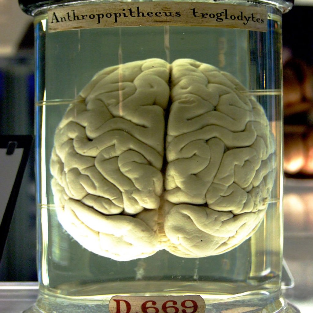 813px-Chimp_Brain_in_a_jar