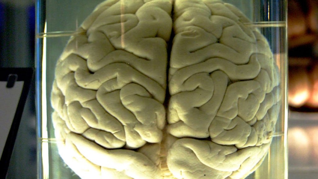 813px-Chimp_Brain_in_a_jar