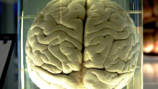813px-Chimp_Brain_in_a_jar