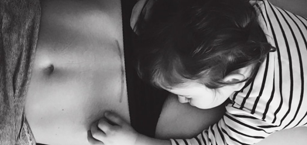 federica-simoni-mamafedora-c-section-scar-little-boy-750x550